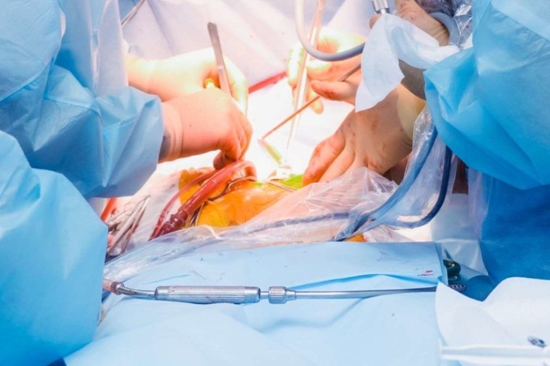 Laparoscopic Endometriosis Surgery